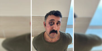 Polîsan hem îşkence lê kirin û hem jî xwestin sûcê xwe binixumînin