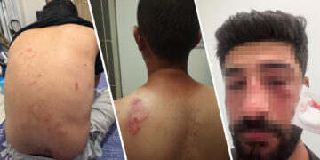 Komek nijadperest li Mêrsînê êrişî malbateke Kurd kir