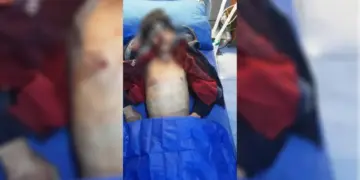 Di êrîşên li dijî taxên Helebê de zarokek jiyana xwe ji dest da