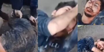  Rewşa weşîya Dîyar Koçî giran a