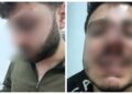 Li Wanê hovîtiya polîsan: Bi îşkenceyê poz û diranên ciwanekî şikandin