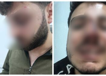 Li Wanê hovîtiya polîsan: Bi îşkenceyê poz û diranên ciwanekî şikandin