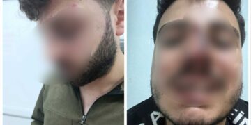 Li Wanê hovîtiya polîsan: Bi îşkenceyê poz û diranên ciwanekî şikandin